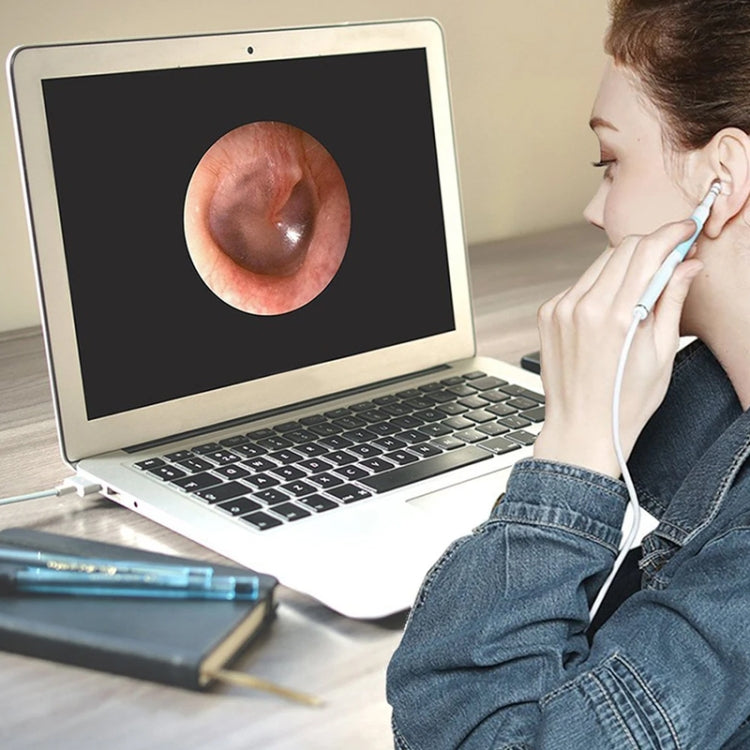 3-in-1 USB ear inspection camera in use with laptop, showing ear view, white 0.3MP