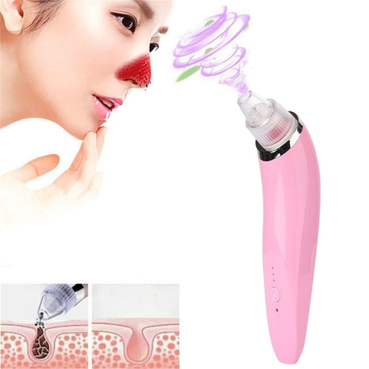 Pink handheld blackhead extractor with suction tip and clear chamber