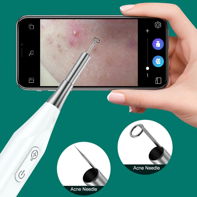 Supereyes Y009 Visual Ear Pick Acne Cleaning Microscopic Magnifying Mirror Endoscope, Y009