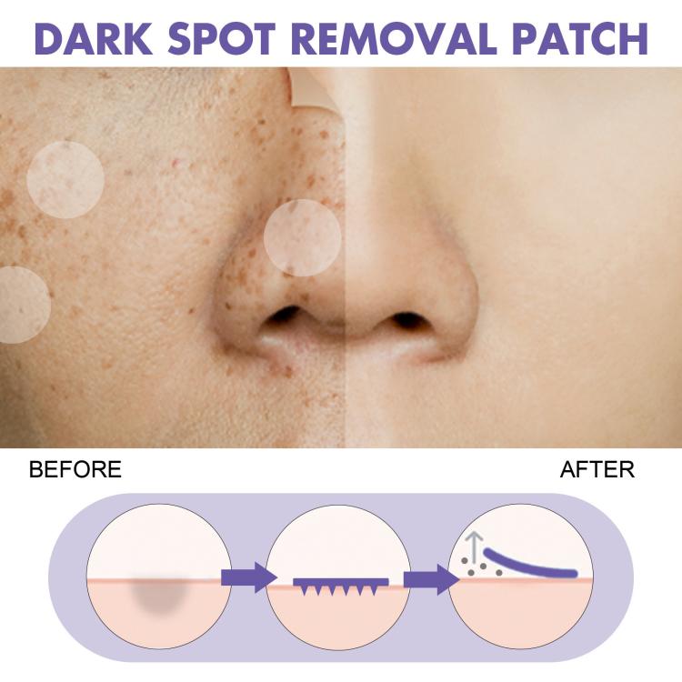 Before and after nose view with dark spot removal patch application diagram