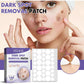 EELHOE dark spot removal patch kit shown on face with box and circular sheet