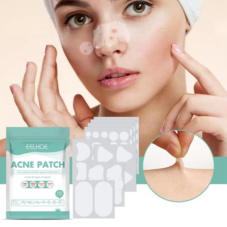 Breathable hydrocolloid acne patches shown on a woman’s face near cheeks and nose
