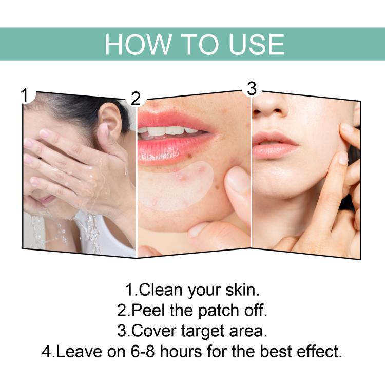 Breathable hydrocolloid acne patch usage steps for cleaning, peeling, covering, and wearing