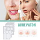 Breathable hydrocolloid acne patches placed on cheeks and lip area on a woman’s face