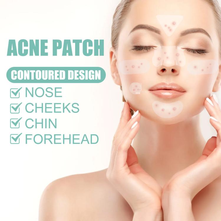 Breathable hydrocolloid acne patch placement guide on nose, cheeks, chin, and forehead