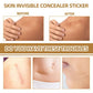 JAYSUING Waterproof Skin Scar Acne Mark Covering Patch, Acne Mark Covering Patch