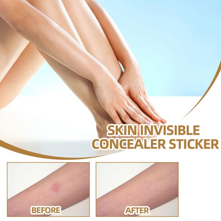JAYSUING Waterproof Skin Scar Acne Mark Covering Patch, Acne Mark Covering Patch