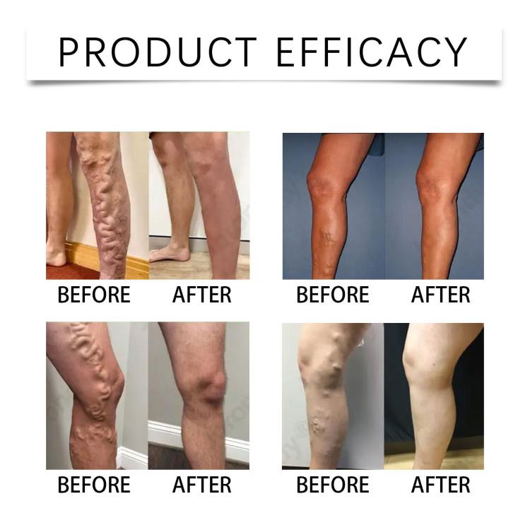 LANISKA Skin-Locking Moisturizing Leg Care Patches, Leg Care Patches