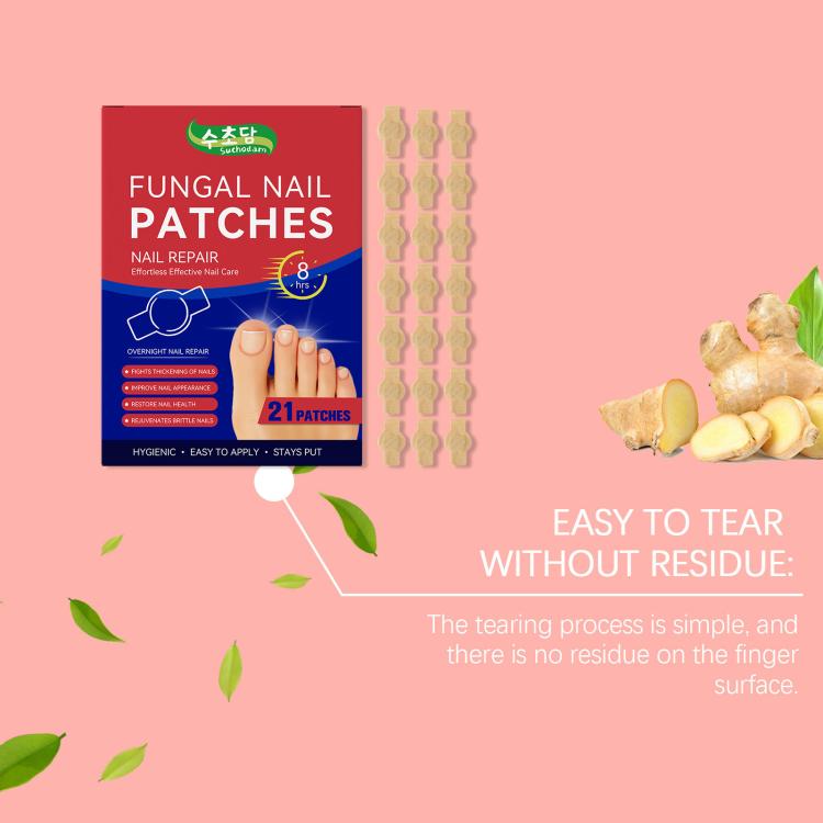 Nail patch treatment kit with box, tear-off design shown on adhesive strip segments