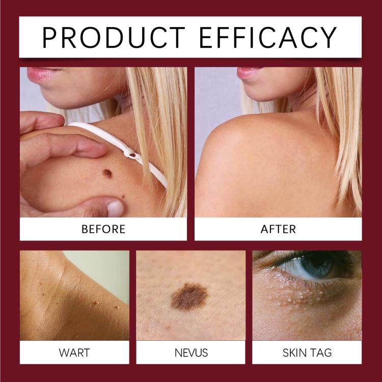 Skin hydrating care patch application shown in before-and-after skin panels