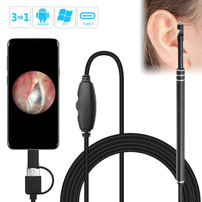 Black USB ear inspection scope with probe and smartphone screen