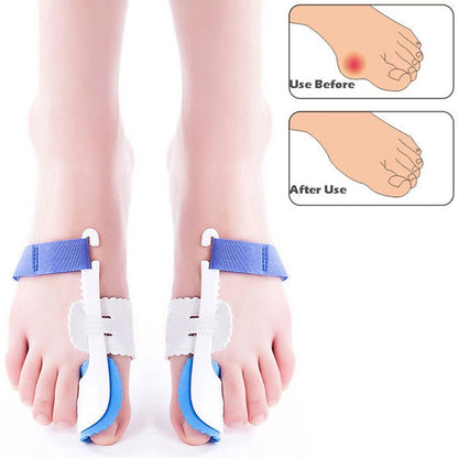 Pair of blue-and-white night bunion splints worn on both feet
