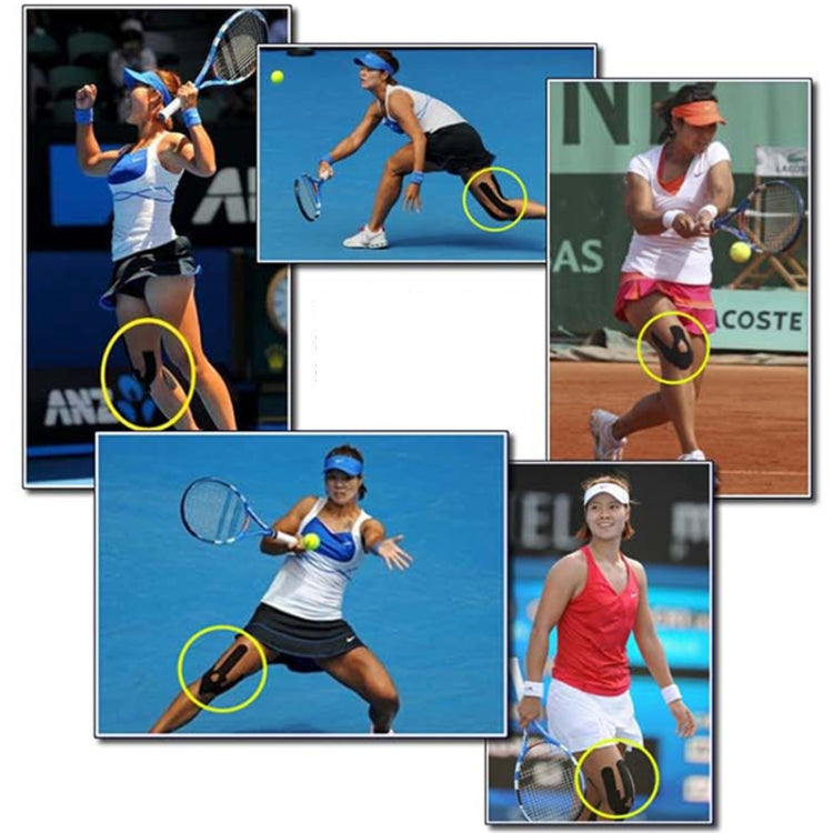 Kinesiology tape on tennis players' legs and arms shown as support stripes