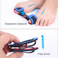 Bunion corrector toe spacer on feet with blue pads and black strap