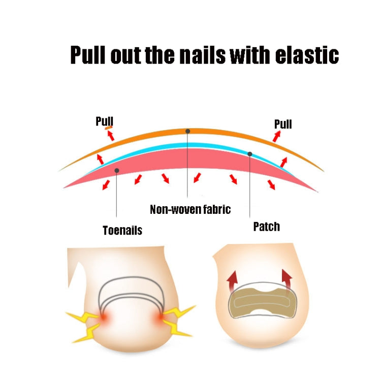 Toe nail patch usage graphic with beige patch on toenail and pull directions