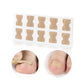 Toe nail correction sticker set with close-up patch application on two toes