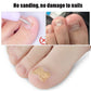 Toe nail correction patch sticker on toenail, beige square patch without tools