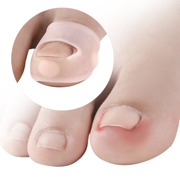 Ingrown Nails Prevent Nails From Growing Flesh Nail Corrections, Free Size