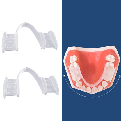 Clear silicone anti-molar orthodontic mouthguard with molded teeth guards, two pieces