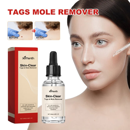 Skin-clear mole remover serum bottle with dropper and red-and-beige package box