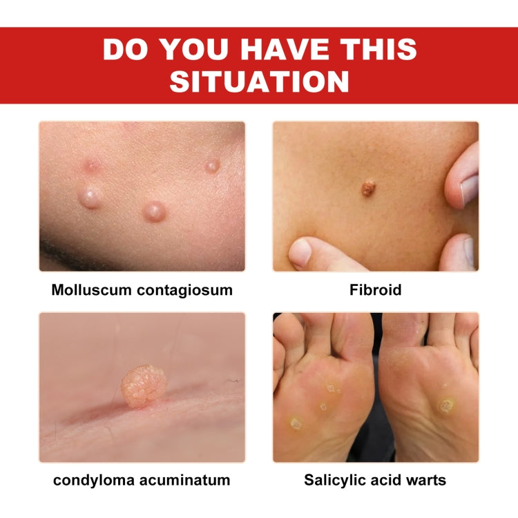 Close-up examples of raised skin bumps on skin patches and hands