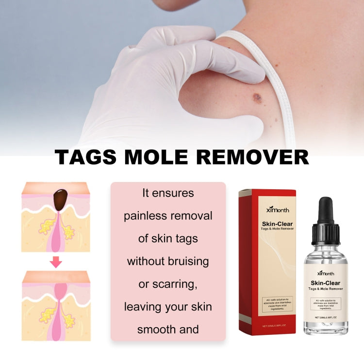 Gloved hand using mole remover serum; Skin-Clear bottle and red package box