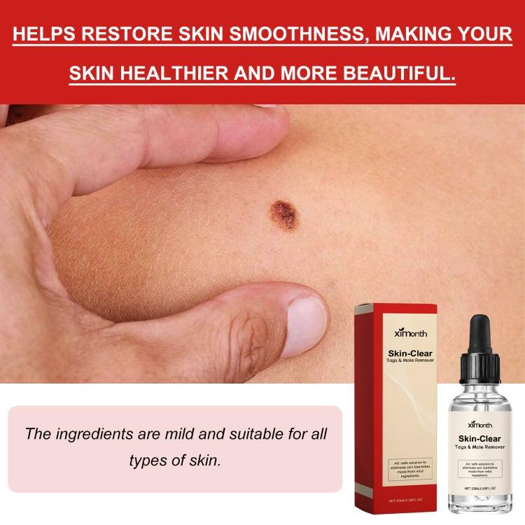 Skin with dark spot and mole remover serum bottle beside red-and-beige Skin-Clear box