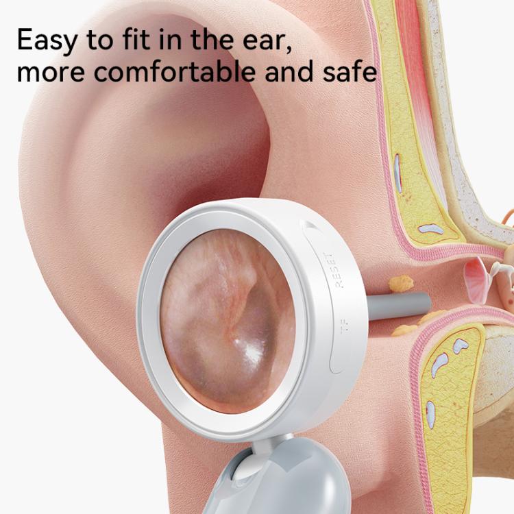 Ear inspection camera adapter with silicone rim positioned against an ear