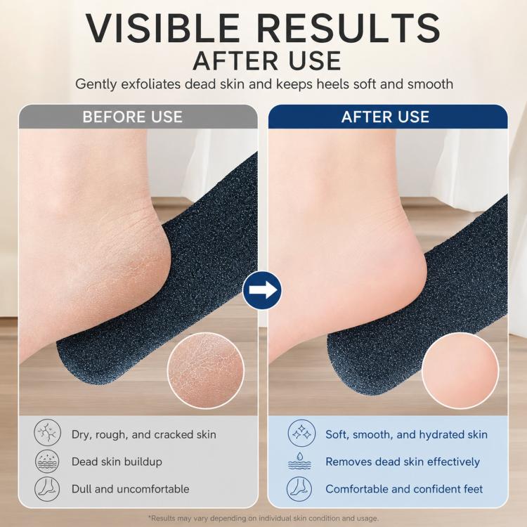 Foot callus remover with dark abrasive pad for exfoliating heels, before and after view